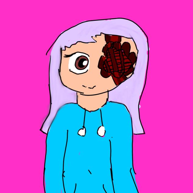 Alex… (DISCLAIMER GORE AND FLASH)