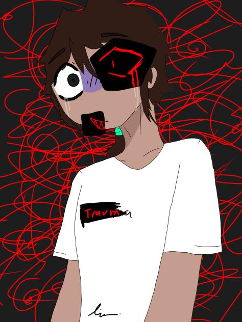 Trauma