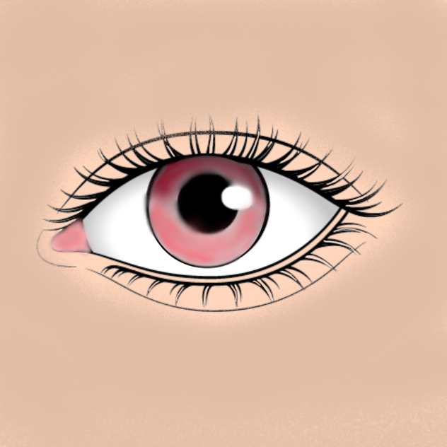 A eye I did myself! totally…………..