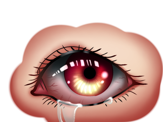 EYE