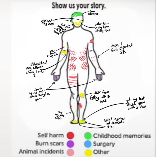 My story