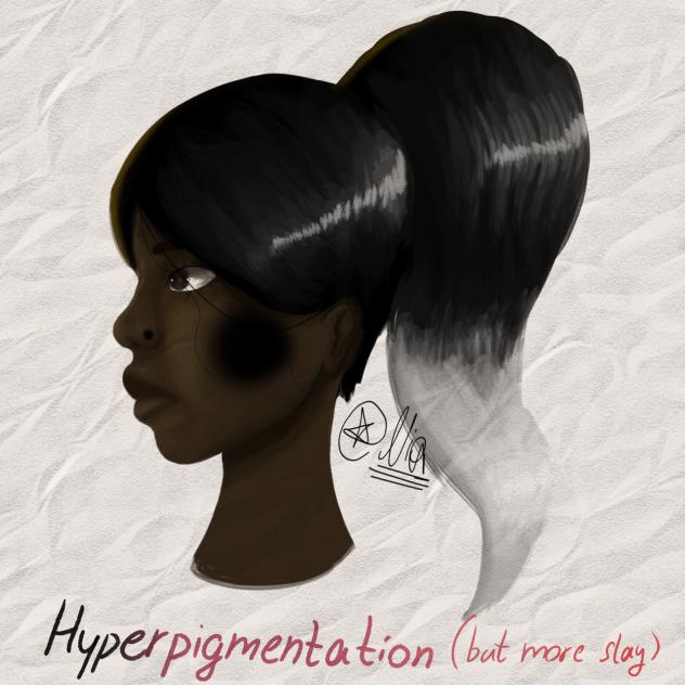 HYPERPIGMENTATION 🗣🗣🗣