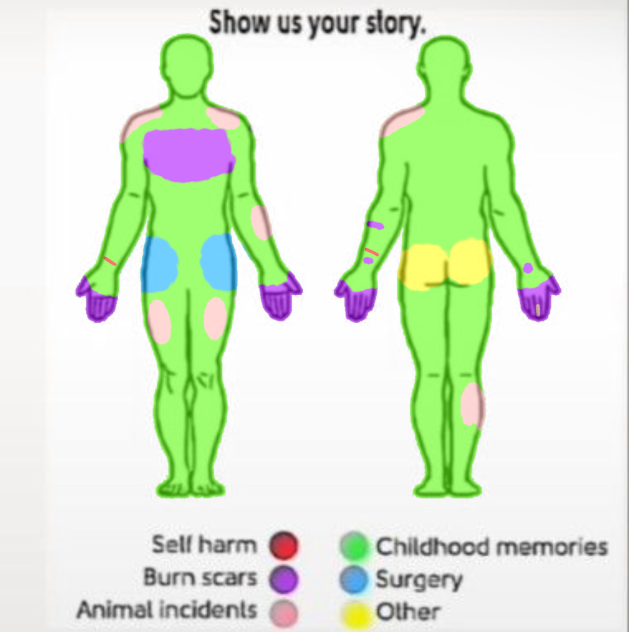 Show us your story