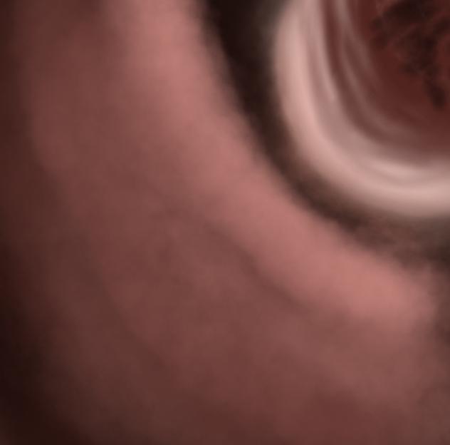 The eye of a crazy man...