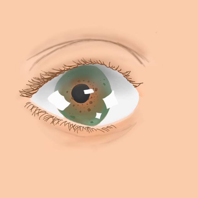 Hazel eye