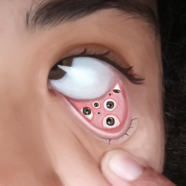something is bothering my eye