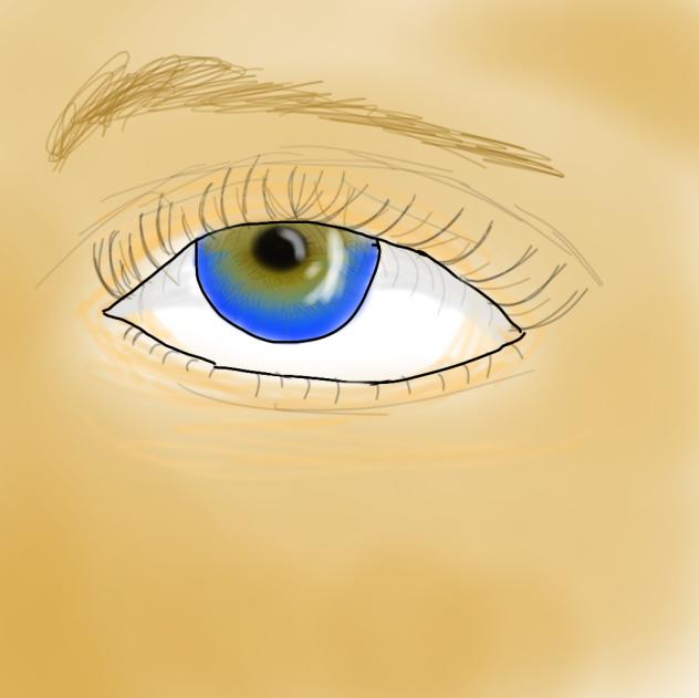Central heterochromia