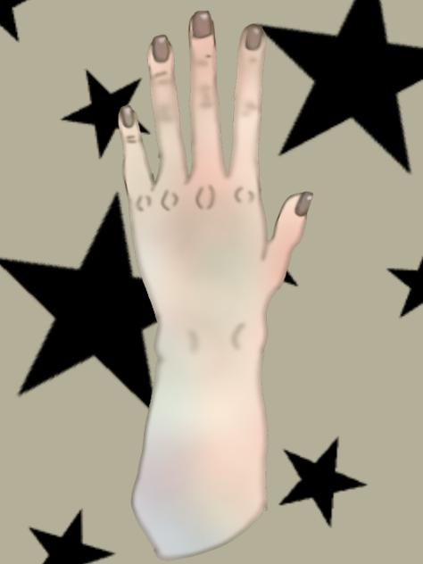 Hand Ig