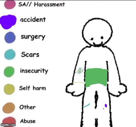 Pain chart idk